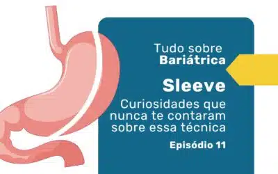 Sleeve gástrico: principais curiosidades