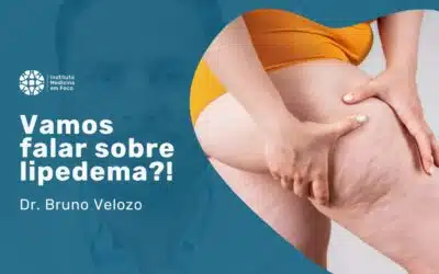 Lipedema: entenda o excesso de gordura nas pernas