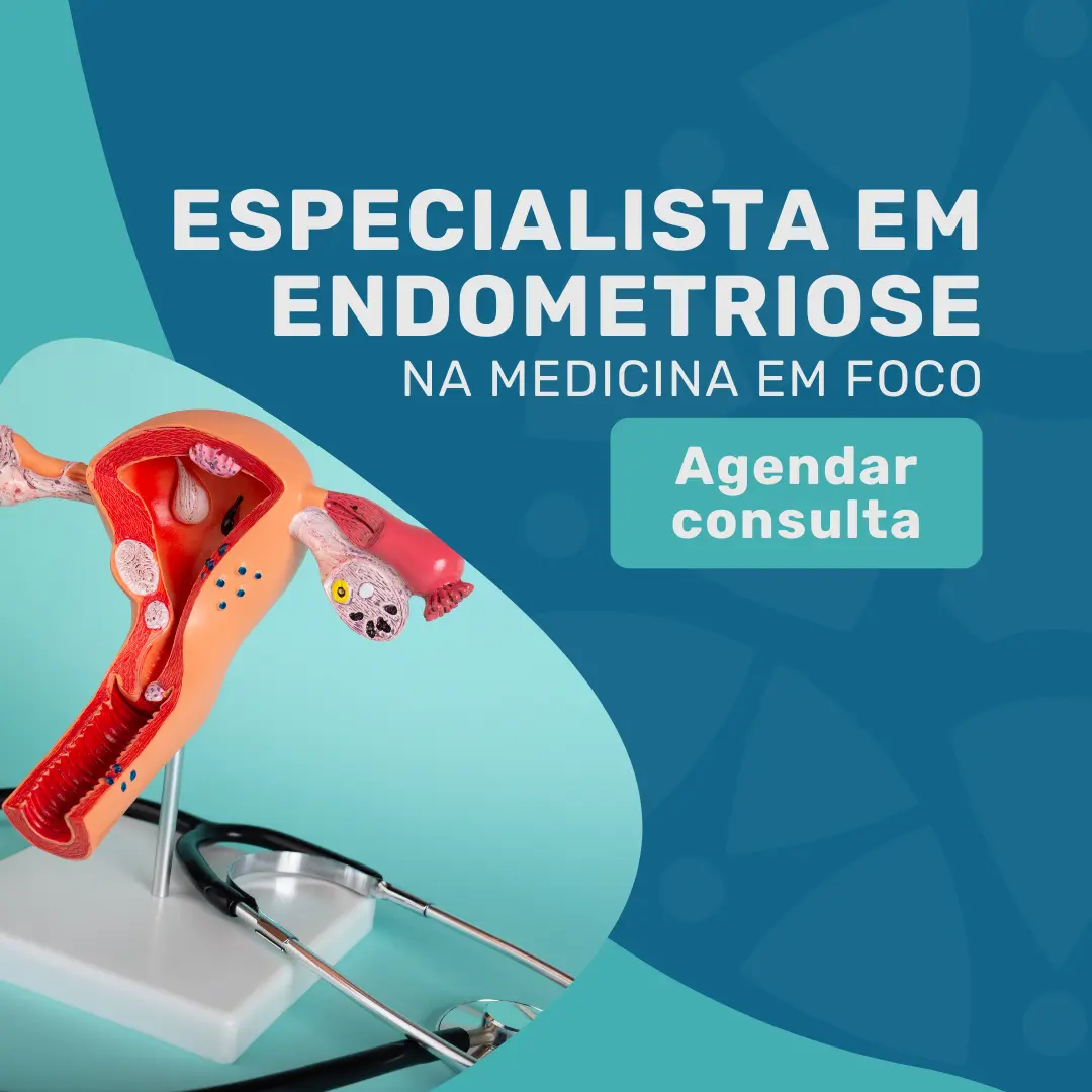 Agende sua consulta com um Especialista em Endometriose pelo Saúde Caixa