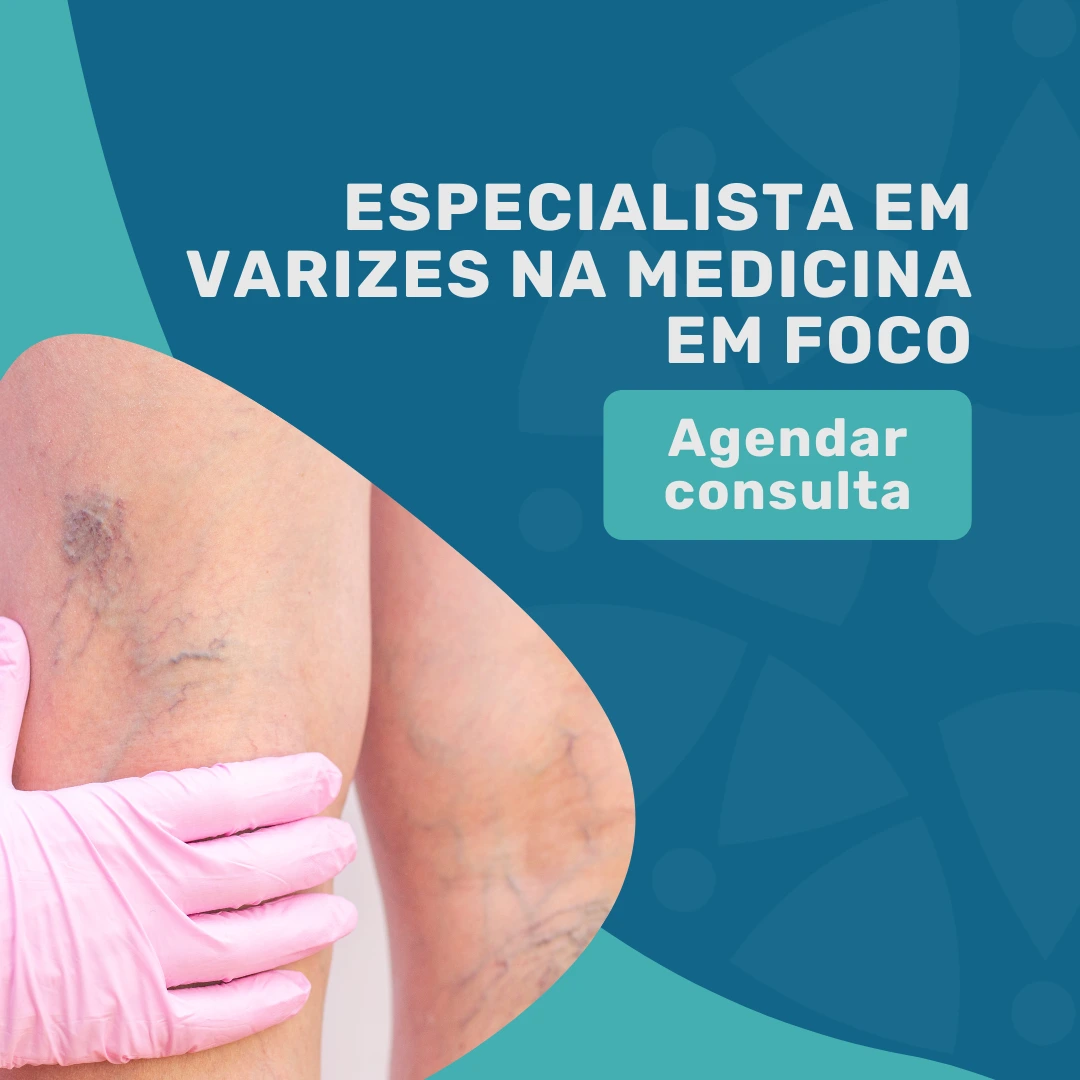 Encontre o seu especialista em varizes para o tratamento de varizes pelo plano de saúde Bradesco