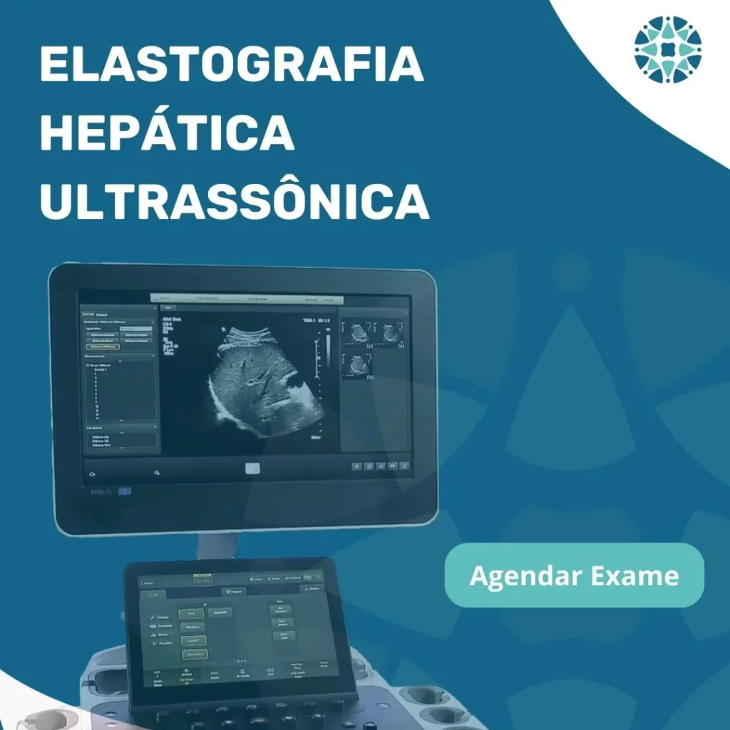 Agende seu exame elastografia hepática ultrassonica no Instituto Medicina em Foco, com qualidade e preço acessível.