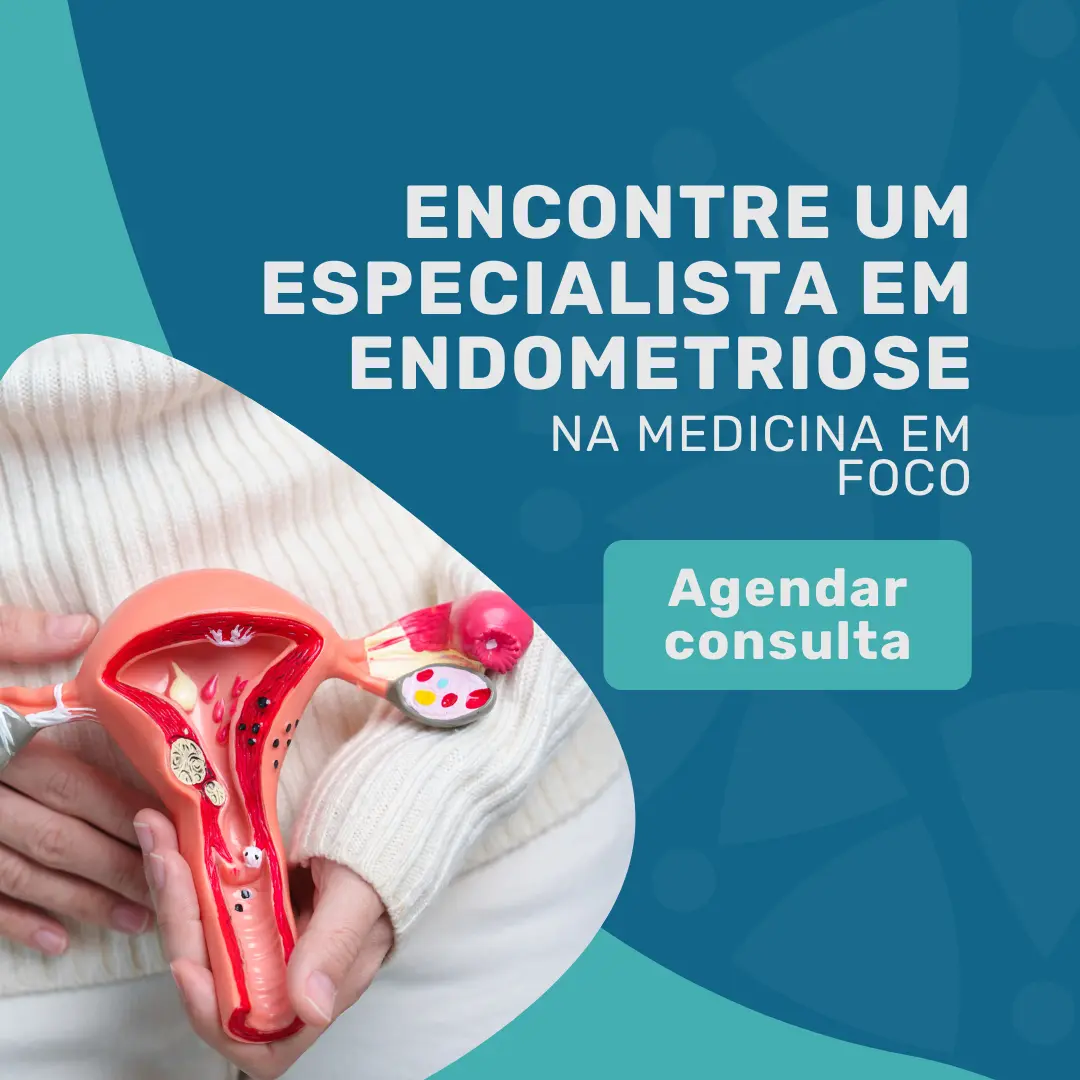 Encontre o seu Endometriose pela Allianz em São Paulo na Medicina em Foco